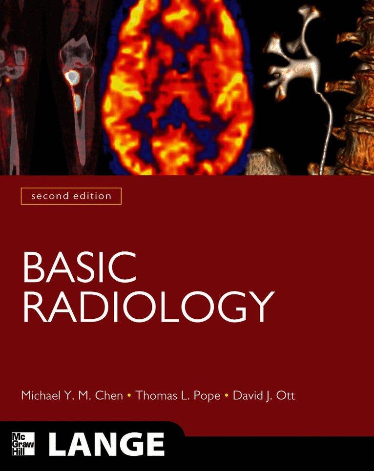 Basic Radiology, Second Edition