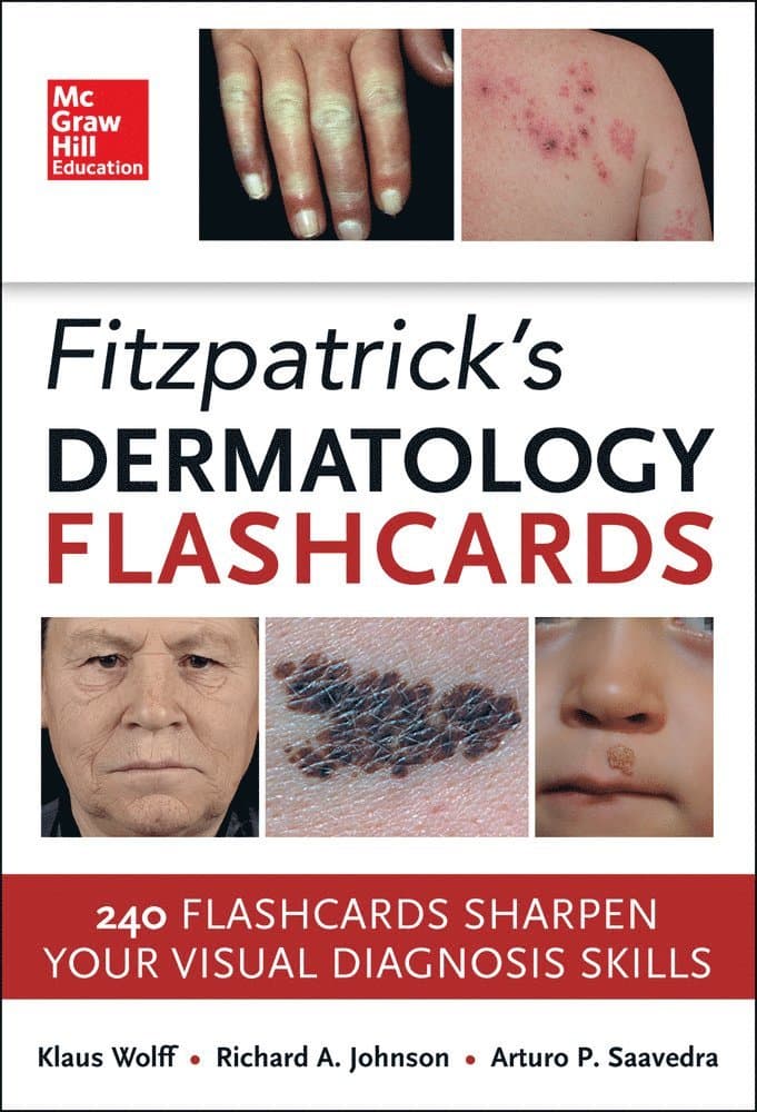 Fitzpatricks Dermatology Flash Cards