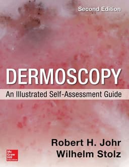 Dermoscopy: An Illustrated Self-Assessment Guide, 2/e