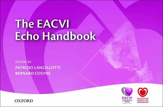 The EACVI Echo Handbook