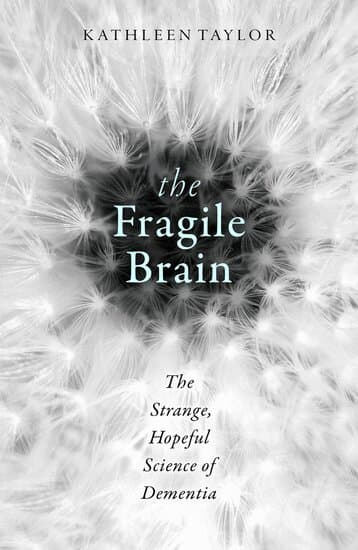 The Fragile Brain