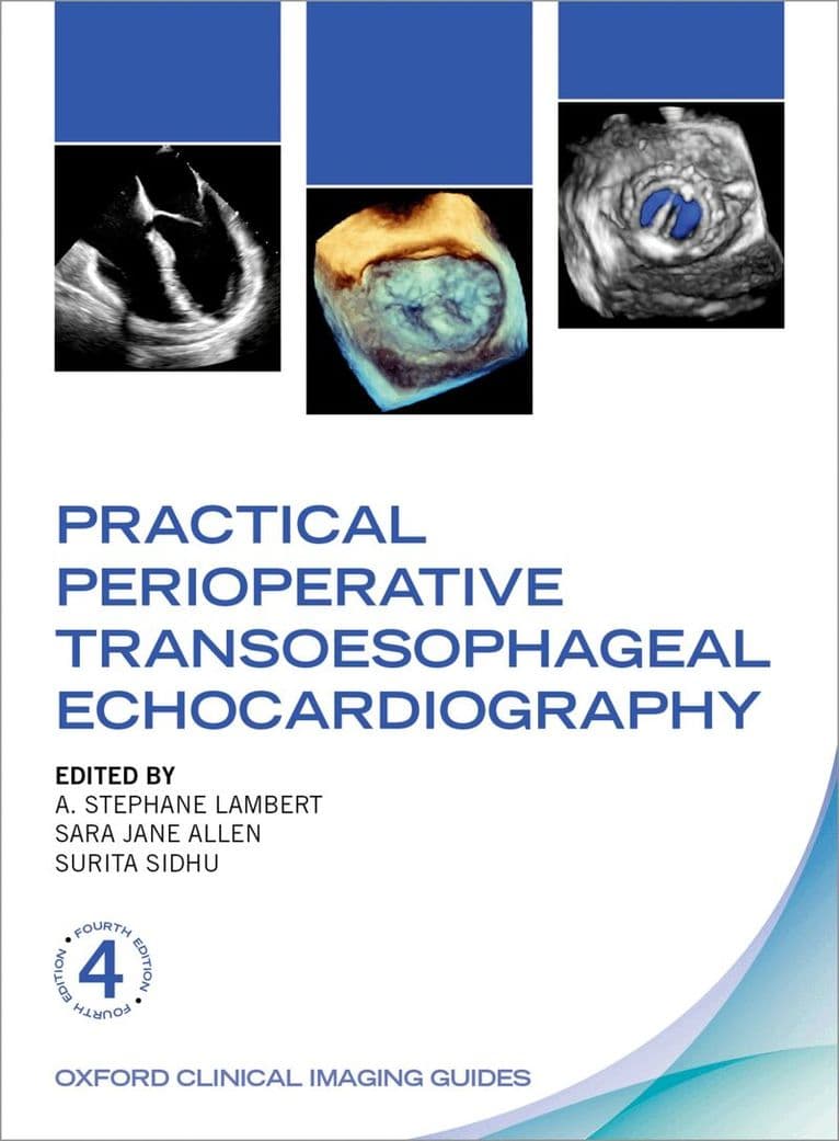 Practical Perioperative Transoesophageal Echocardiography