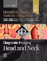 Diagnostic Imaging: Head and Neck