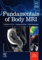 Fundamentals of Body MRI