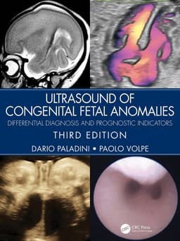 Ultrasound of Congenital Fetal Anomalies