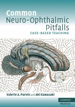 Common Neuro-Ophthalmic Pitfalls