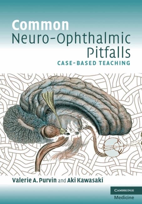 Common Neuro-Ophthalmic Pitfalls