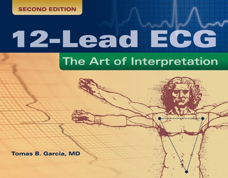 12-Lead ECG: the Art of Interpretation