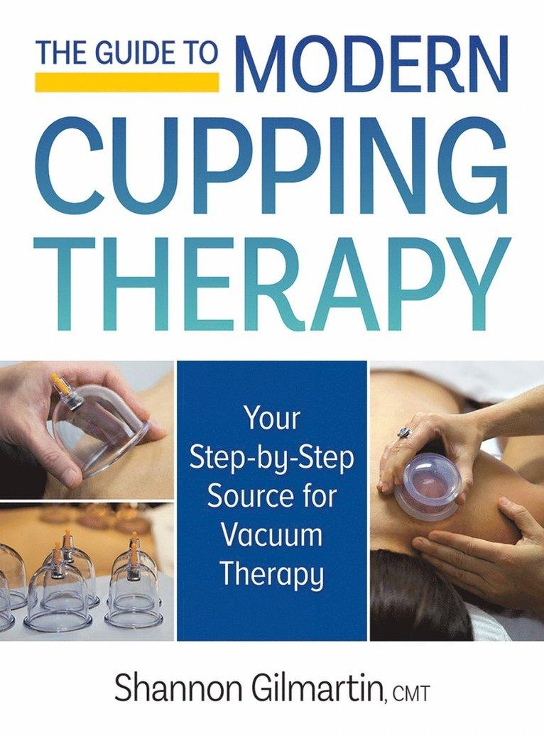 Guide to Modern Cupping Therapy