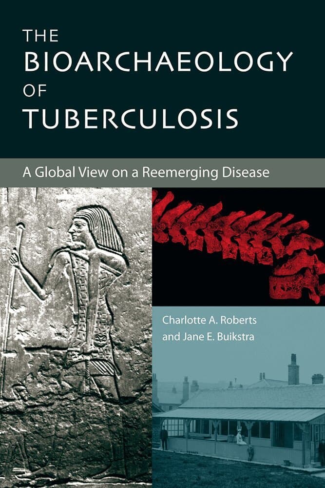 Bioarchaeology of Tuberculosis