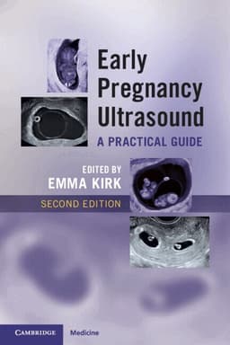 Early Pregnancy Ultrasound