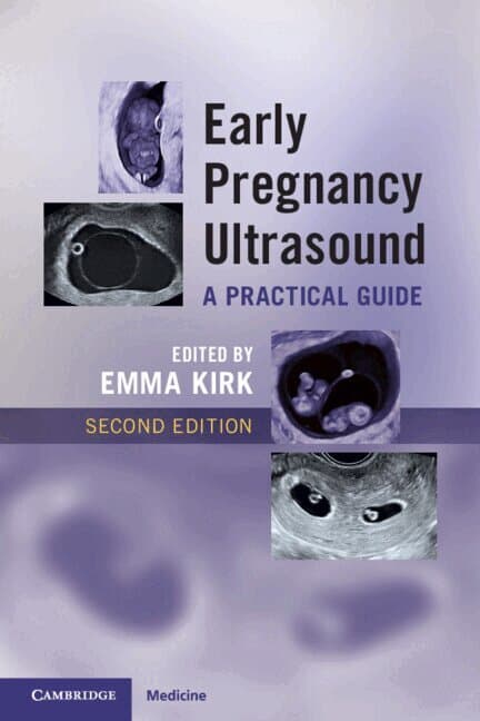 Early Pregnancy Ultrasound