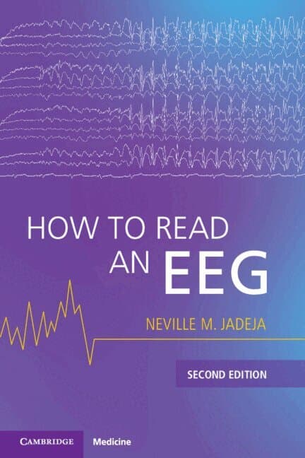 How to Read an EEG