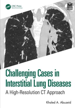 Challenging Cases in Interstitial Lung Diseases