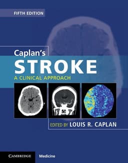 Caplan's Stroke