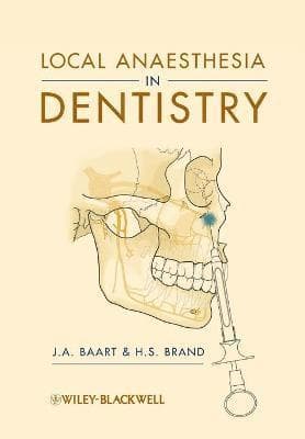 Local Anaesthesia in Dentistry