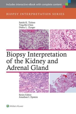 Biopsy Interpretation of the Bone Marrow: Print + eBook with Multimedia