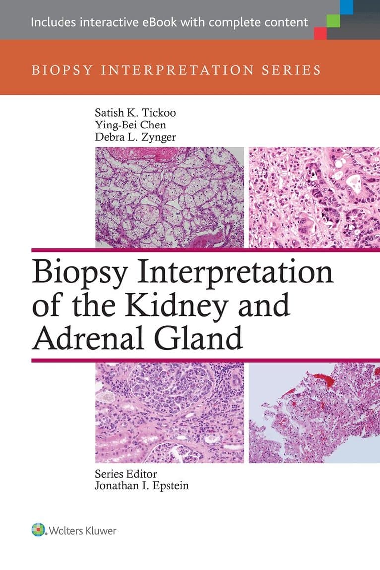 Biopsy Interpretation of the Bone Marrow: Print + eBook with Multimedia