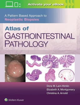 Atlas of Gastrointestinal Pathology: A Pattern Based Approach to Neoplastic Biopsies