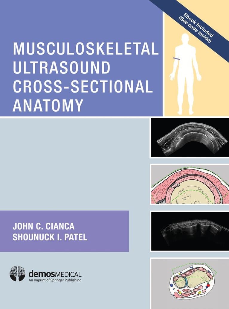 Omslag till boken Musculoskeletal Ultrasound Cross-Sectional Anatomy av John C. Cianca