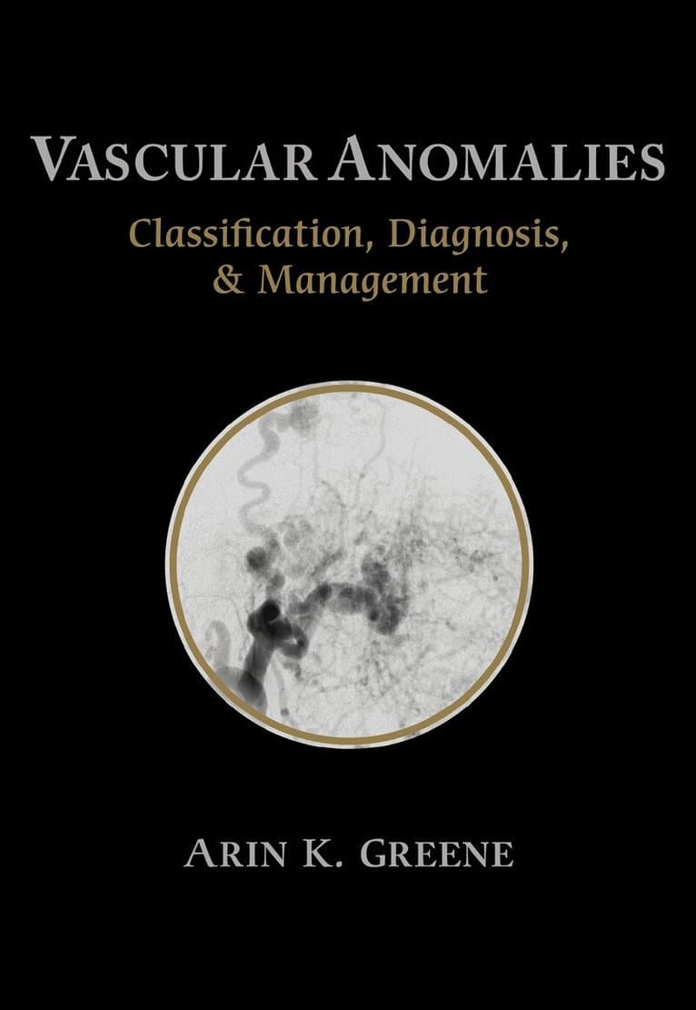 Vascular Anomalies