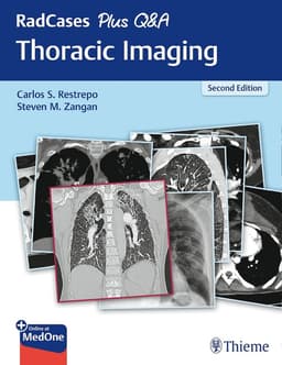 RadCases Plus Q&a Thoracic Imaging