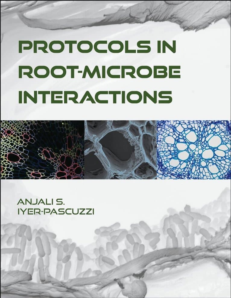 Protocols in Root-Microbe Interactions