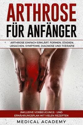 Arthrose Für Anfänger: Arthrose Einfach Erklärt. Formen, Stadien, Ursachen, Symptome, Diagnose Und Therapie. Inklusive Vorbeugungs- Und Ernäh