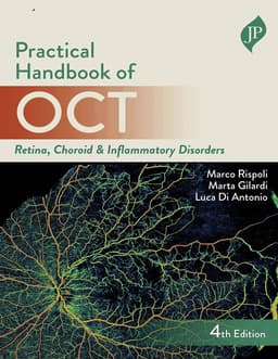 Practical Handbook of OCT