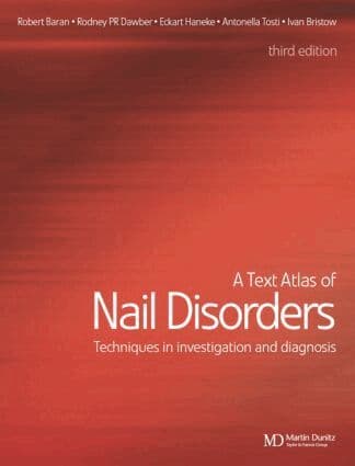 Text Atlas of Nail Disorders