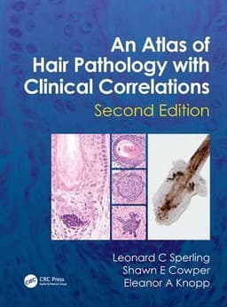 Atlas of Hair Pathology with Clinical Correlations