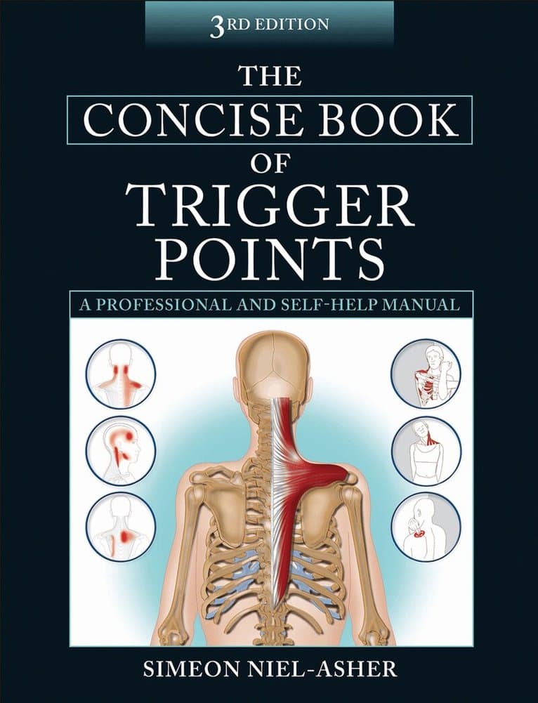 Concise Book of Trigger Points