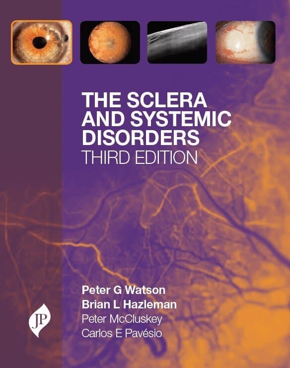 Sclera and Systemic Disorders