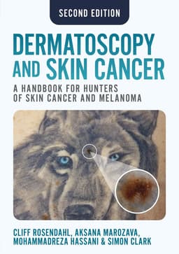 Dermatoscopy and Skin Cancer, second edition