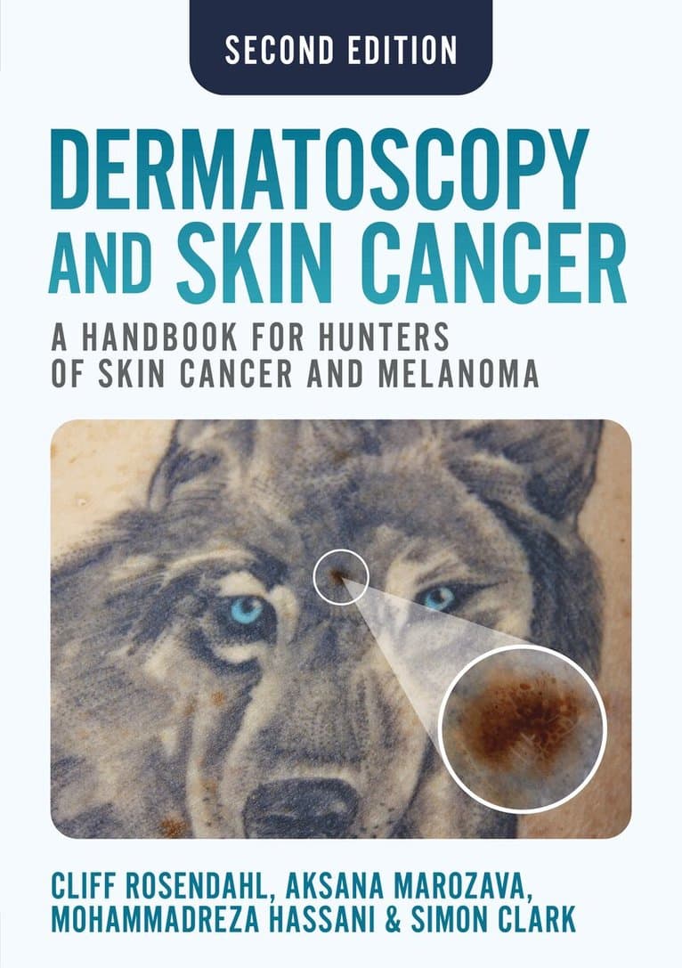 Dermatoscopy and Skin Cancer, second edition