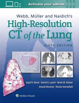 Fundamentals of High-Resolution Lung CT