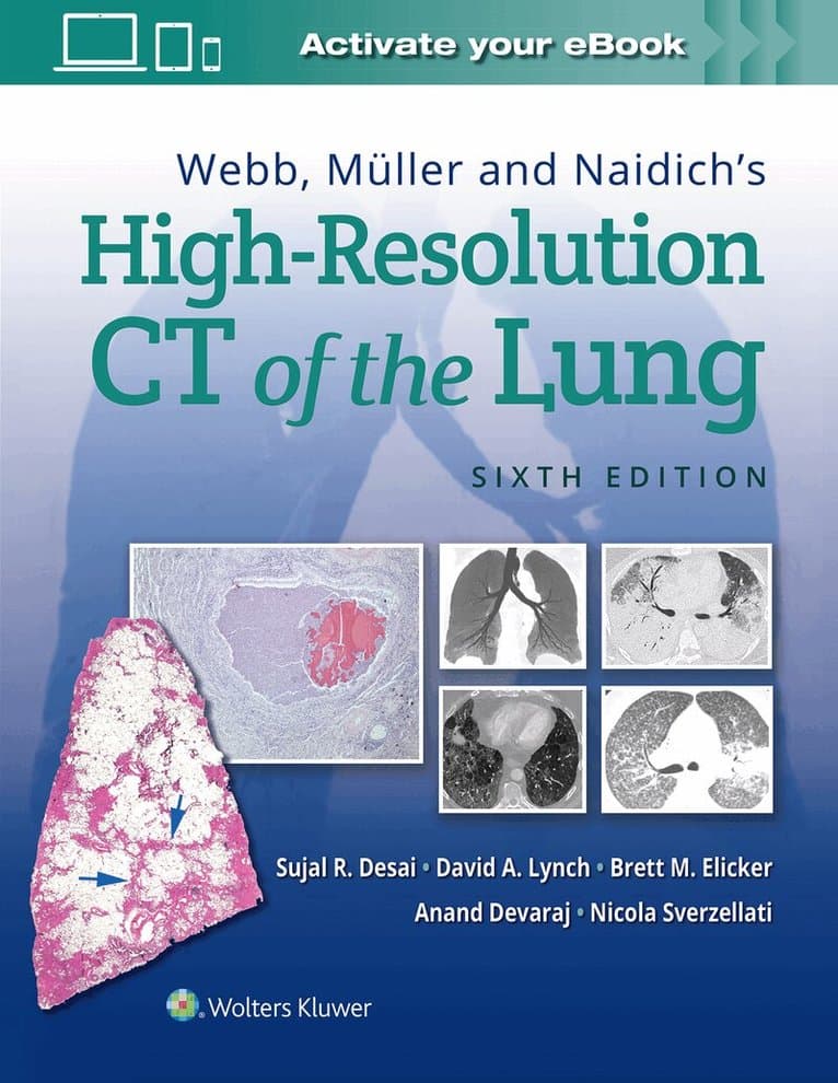 Fundamentals of High-Resolution Lung CT