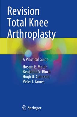 Revision Total Knee Arthroplasty