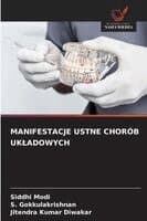Manifestacje Ustne Chorób Ukladowych