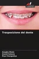 Trasposizione del dente