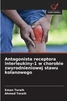 Antagonista receptora interleukiny-1 w chorobie zwyrodnieniowej stawu kolanowego