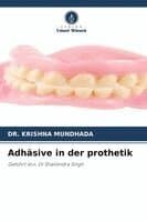 Adhäsive in der prothetik