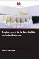 Restauration de la dent traitée endodontiquement