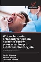 Wplyw leczenia ortodontycznego na korzenie zębów przeszczepionych autotransplantacyjnie