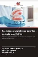 Prothèses obturatrices pour les défauts maxillaires