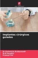 Implantes cirúrgicos guiados