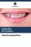 Zahntransposition