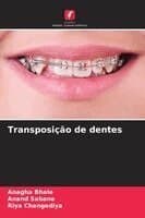 Transposição de dentes