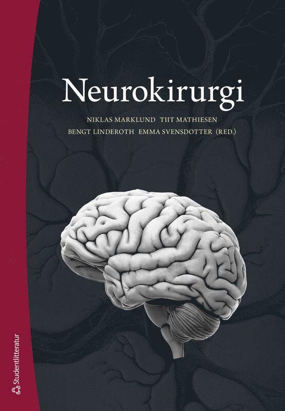 Neurokirurgi