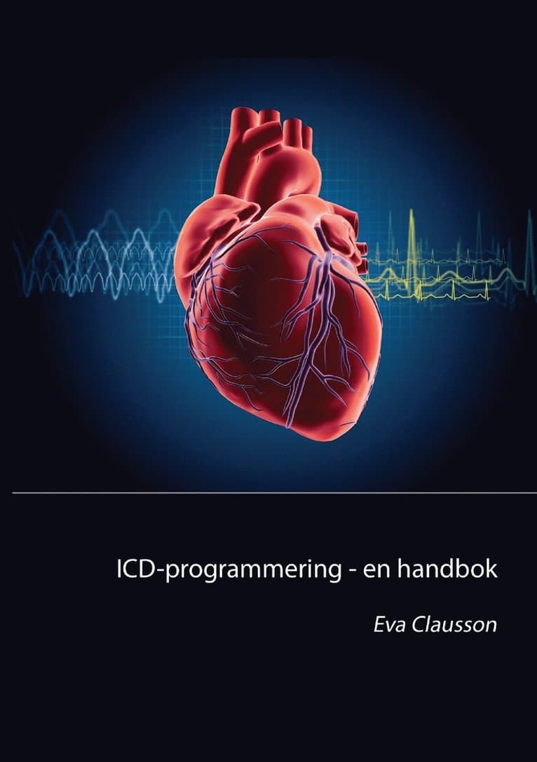 ICD-programmering: En handbok
